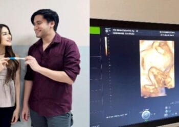 Kevin Aprilio Umumkan Kehamilan Pertama Istrinya Vicy Melanie di usia 4 tahun Pernikahan 1 Kevin Aprilio Umumkan Kehamilan Pertama Istrinya Vicy Melanie di usia 4 tahun Pernikahan