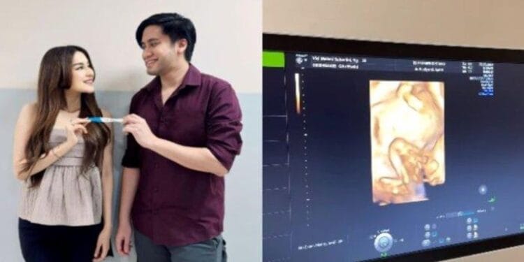 Kevin Aprilio Umumkan Kehamilan Pertama Istrinya Vicy Melanie di usia 4 tahun Pernikahan